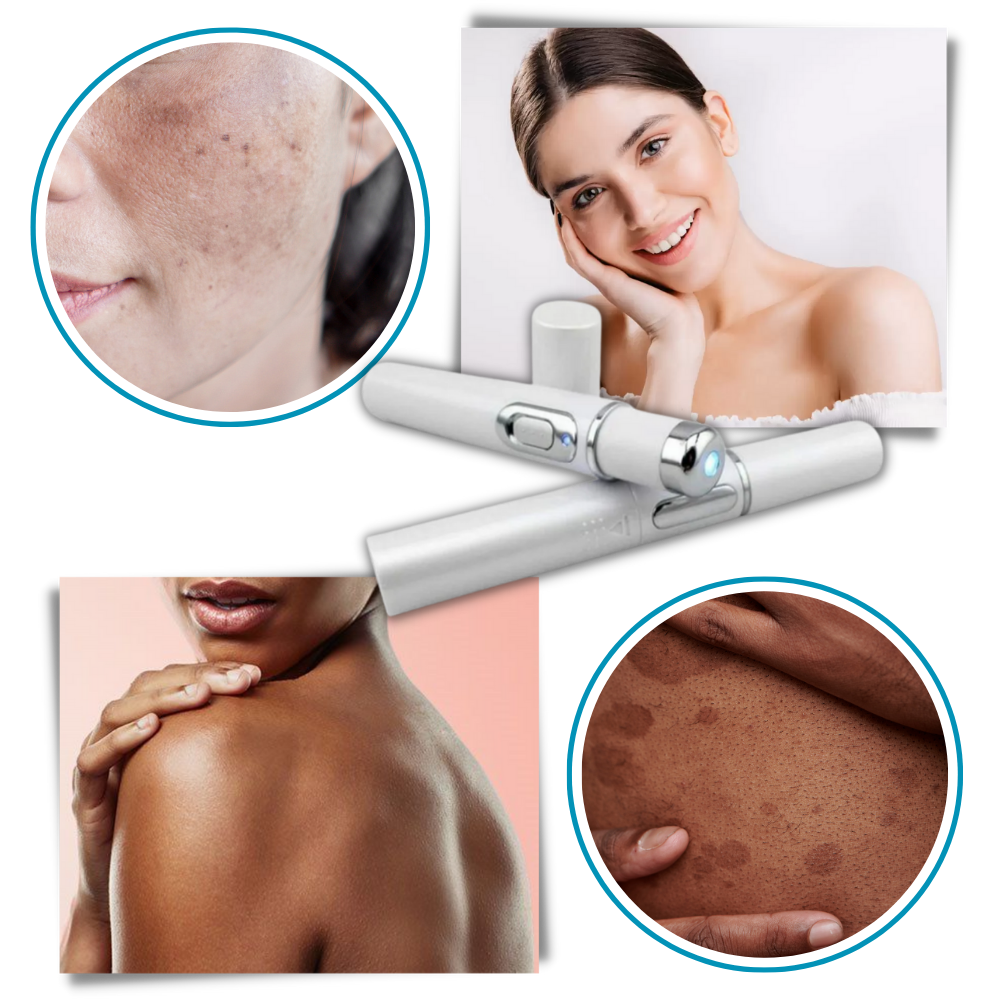 DermaPure | Draagbare lasertherapie voor een heldere teint