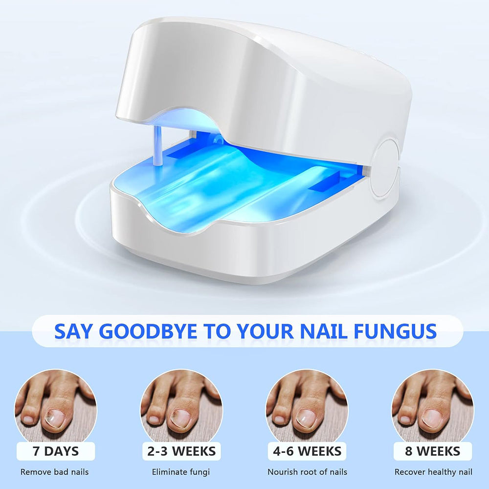 Thuis Laser Behandeling Voor Schimmelnagels NexaLume