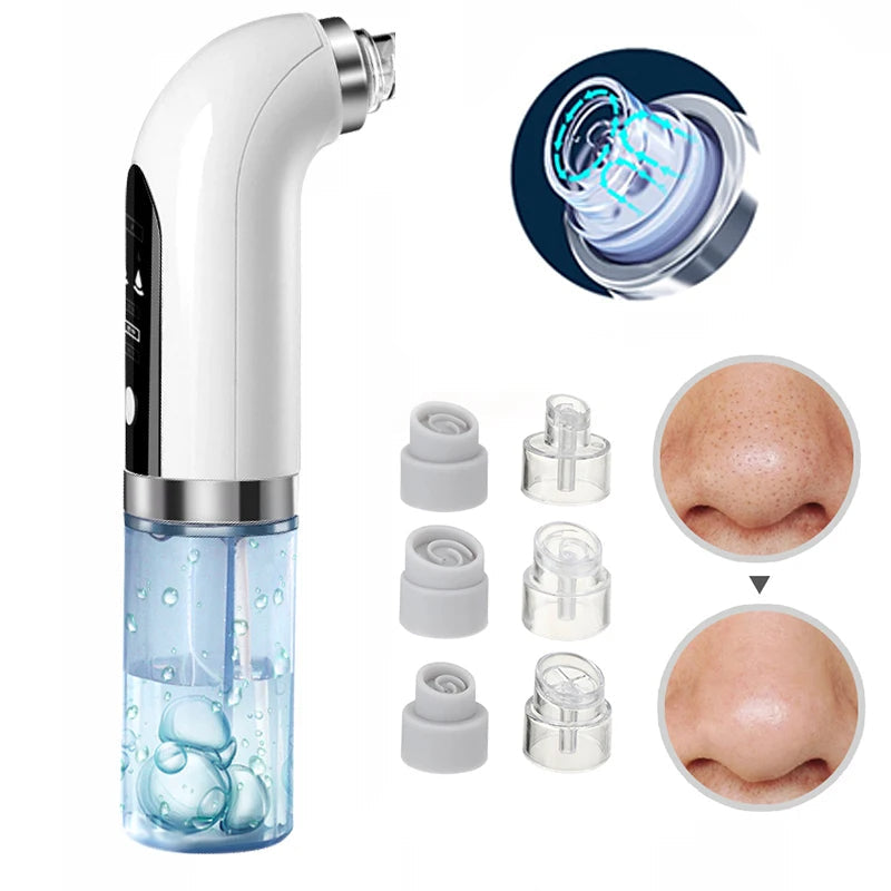 Skanto | Professionele Neus Blackhead Verwijderaar Vacuüm - Diepe Reiniging met Zuigtechnologie