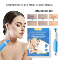 Verwijderingskit voor Acrochordons - Eenvoudige Cryotherapie