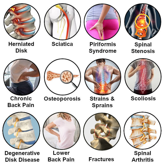 MagnaSpine – Orthopedische Magnetische Ondersteuningsriem