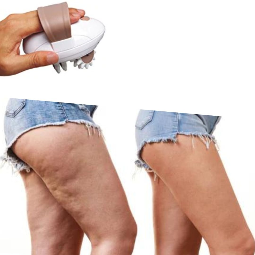 Smooth Tone elektrisch massageapparaa | Bestrijdt cellulitis, verstevigt de huid en verlicht spierspanning