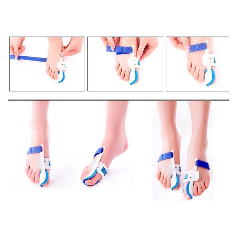 Orthopedische Hallux Valgus Corrector (nachtelijk gebruik) - Verstelbaar voor meerdere voetmaten