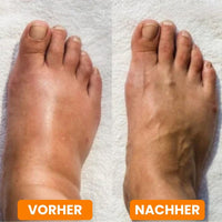 EMS-Voetmassageapparaat voor diepe ontspanning | RelaxVoet