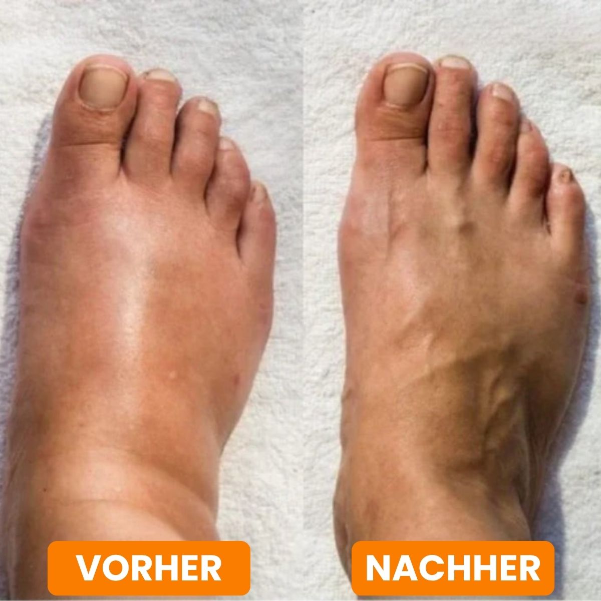 EMS-Voetmassageapparaat voor diepe ontspanning | RelaxVoet