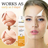 SkinClear | Spray Verwijder Wratten – Zachte en Effectieve Behandeling
