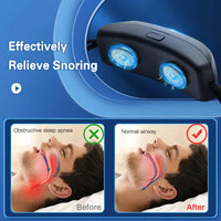 Slimme Anti-Snurkapparaat EMS Pulse Stop Snore Draagbaar Comfortabel Slaap Goed Stop Snurken Gezondheidszorg Slaap Apneu Hulp USB