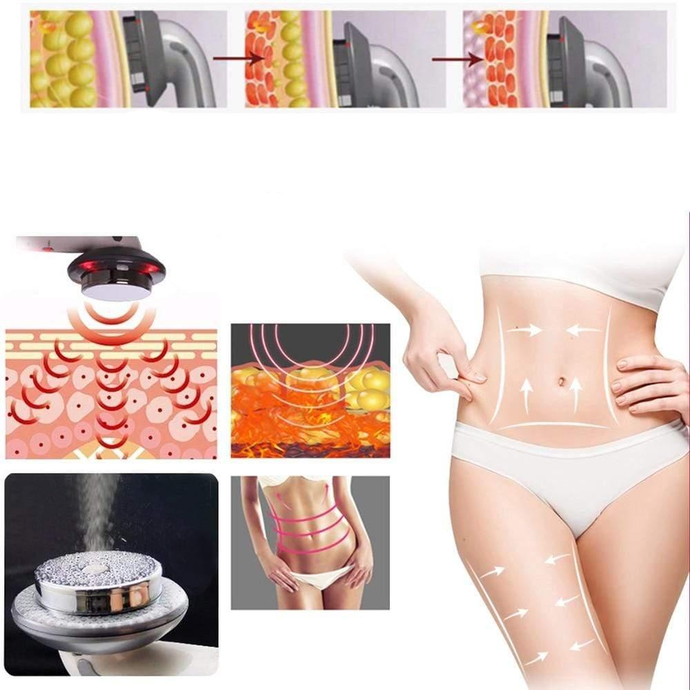 Ultra Sculpt-afslankapparaat | Veilige en effectieve vetverbranding met EMS, infrarood en ultrasone therapie.