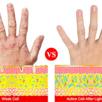 ArthroGlow Near Infrared Handtherapie Handschoenen Voor Artritis Pijnverlichting