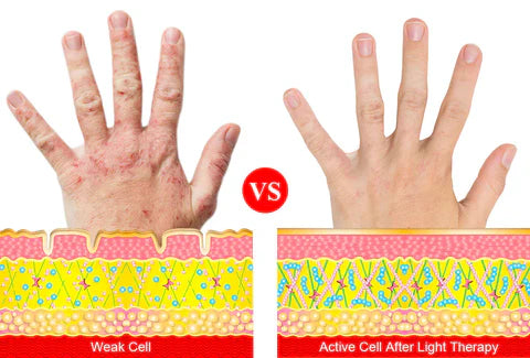 ArthroGlow Near Infrared Handtherapie Handschoenen Voor Artritis Pijnverlichting
